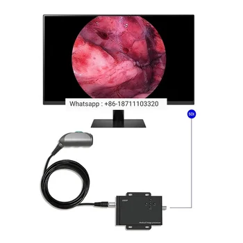 Poceni Prenosni Medicinski, Veterinarski Endoskop Cena z 1080P Fhd Država Endoskopijo Fotoaparat